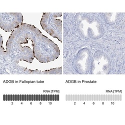 ADGB Antibody, Novus Biologicals 25 &mu;L, Unlabeled:Antibodies, Polyclonal
